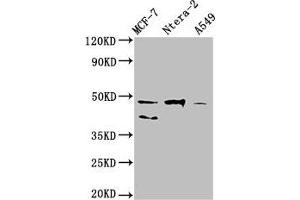 Western Blot Positive WB detected in: MCF-7 whole cell lysate, Ntera-2 whole cell lysate, A549 whole cell lysate All lanes: NANOG antibody at 1:500 Secondary Goat polyclonal to Mouse IgG at 1/10000 dilution Predicted band size: 35, 33 kDa Observed band size: 46, 40 kDa (Nanog Antikörper  (AA 1-305))