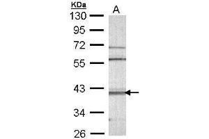 WB Image Sample (30 ug of whole cell lysate) A: Molt-4 , 10% SDS PAGE antibody diluted at 1:1000 (CAMK1D Antikörper)