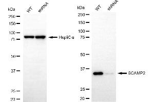 Western blotting analysis using SCAMP2 antibody (ABIN7800289). (SCAMP2 Antikörper)
