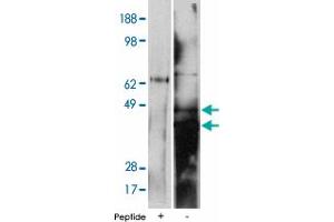 Western blot using DEGS2 polyclonal antibody on human kidney cell lysate at 15 ug/lane. (DEGS2 Antikörper)
