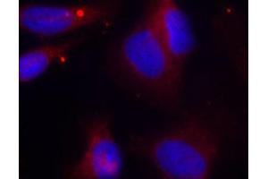 Immunofluorescence (IF) image for anti-zeta-Chain (TCR) Associated Protein Kinase 70kDa (ZAP70) (pTyr319) antibody (ABIN3023646)