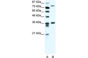 Western Blotting (WB) image for anti-Midline 1 (MID1) antibody (ABIN2461022)
