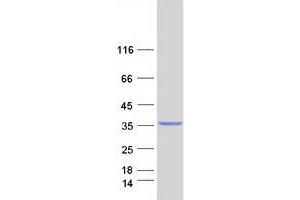 Western Blotting (WB) image for Mucin 1 (MUC1) (Transcript Variant 2) protein (Myc-DYKDDDDK Tag) (ABIN2713516)