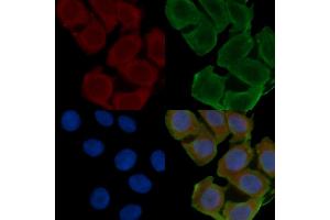 ABIN6262161 and ABIN6266557 staining Hela cells(24h of starvation treatment) by IF/ICC. (HCG beta Antikörper)