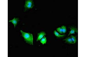 Immunofluorescent analysis of MCF-7 cells using ABIN7163564 at dilution of 1:100 and Alexa Fluor 488-congugated AffiniPure Goat Anti-Rabbit IgG(H+L) (Plastin 3 Antikörper  (AA 310-455))