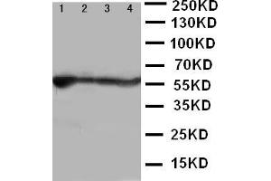 Anti-ALDH2 antibody, Western blotting Lane 1: Rat Liver Tissue Lysate Lane 2: Rat Intestine Tissue Lysate Lane 3: Rat Lung Tissue Lysate Lane 4: Rat Kidney Tissue Lysate (ALDH2 Antikörper  (N-Term))