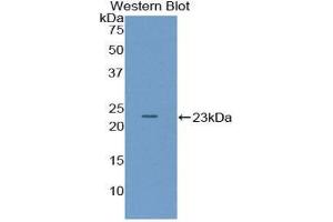 Western Blotting (WB) image for anti-Pituitary Adenylate Cyclase Activating Peptide (AA 1-175) antibody (ABIN1857915) (Pituitary Adenylate Cyclase Activating Peptide (AA 1-175) Antikörper)