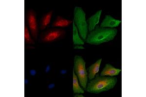 ABIN6261180 and ABIN6278834 staining  cells by IF/ICC.