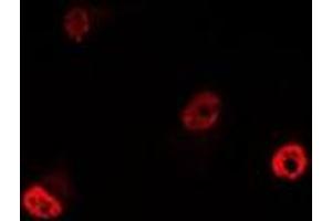 Immunofluorescent analysis of YT521-B staining in MCF7 cells. (YTHDC1 Antikörper)