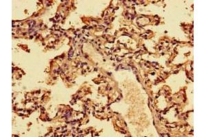 Immunohistochemistry of paraffin-embedded human lung tissue using ABIN7156561 at dilution of 1:100 (IFNA2 Antikörper  (AA 24-188))