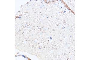 Immunohistochemistry (IHC) image for anti-Monoamine Oxidase A (MAOA) (AA 1-260) antibody (ABIN3021916)