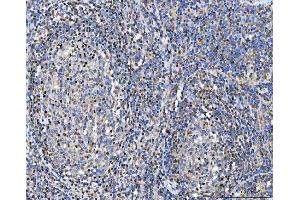 IHC analysis of Glutathione Reductase using anti-Glutathione Reductase antibody (ABIN5693151).