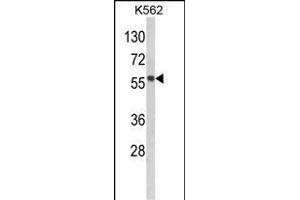 Western blot analysis of hP19- (ABIN390142 and ABIN2840646) in K562 cell line lysates (35 μg/lane). (MMP19 Antikörper  (C-Term))