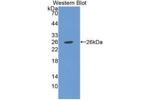 Western blot analysis of the recombinant protein. (CHI3L1 Antikörper  (AA 112-377))