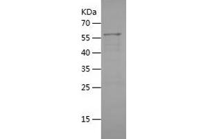 Western Blotting (WB) image for rho Guanine Nucleotide Exchange Factor (GEF) 12 (ARHGEF12) (AA 1268-1484) protein (His-IF2DI Tag) (ABIN7283502) (ARHGEF12 Protein (AA 1268-1484) (His-IF2DI Tag))