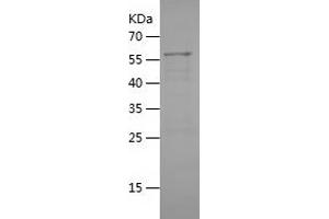 ARHGEF12 Protein (AA 1268-1484) (His-IF2DI Tag)