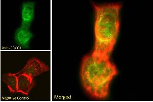ABIN6391360 Immunofluorescence analysis of paraformaldehyde fixed A431 cells, permeabilized with 0. (ERCC1 Antikörper  (Internal Region))