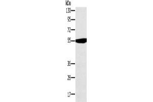 Western Blotting (WB) image for anti-3-Oxoacid CoA Transferase 1 (OXCT1) antibody (ABIN2430595) (OXCT1 Antikörper)