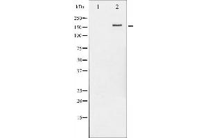 Western blot analysis of HER2 phosphorylation expression in EGF treated MDA-MB-231 whole cell lysates,The lane on the left is treated with the antigen-specific peptide. (ErbB2/Her2 Antikörper  (pTyr877))