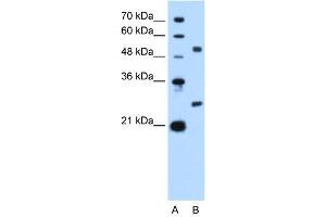 WB Suggested Anti-BCL2L1 Antibody Titration: 2. (BCL2L1 Antikörper  (N-Term))