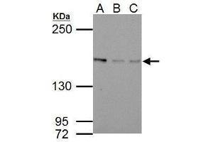 WB Image Sample (30 ug of whole cell lysate)          A: NIH-3T3         B: JC         C: BCL-1         5% SDS PAGE          antibody diluted at 1:1000          (BLM Antikörper  (C-Term))