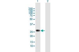 Western Blot analysis of ZC4H2 expression in transfected 293T cell line by ZC4H2 MaxPab polyclonal antibody. (ZC4H2 Antikörper  (AA 1-224))