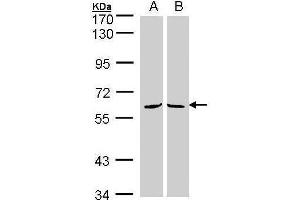 WB Image Sample(30 ug whole cell lysate) A:293T B:H1299 7. (MPP3 Antikörper  (Center))