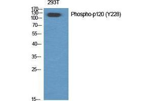 Western Blot (WB) analysis of specific cells using Phospho-p120 (Y228) Polyclonal Antibody.