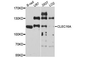Western blot analysis of extracts of various cell lines, using CLEC16A antibody (ABIN5996330) at 1/1000 dilution. (CLEC16A Antikörper)