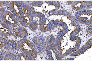 IHC analysis of IQGAP1 using anti-IQGAP1 antibody (ABIN7600509).