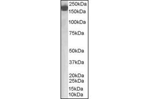 Image no. 2 for anti-Complement Factor H (CFH) (Internal Region) antibody (ABIN372860) (Complement Factor H Antikörper  (Internal Region))