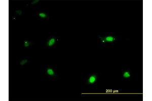 Immunofluorescence of monoclonal antibody to IRX3 on HeLa cell. (IRX3 Antikörper  (AA 182-285))