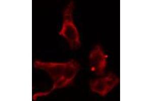 ABIN6274579 staining Hela cells by IF/ICC. (ADCY4 Antikörper  (Internal Region))