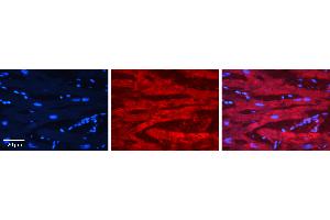 Rabbit Anti-EWSR1 Antibody   Formalin Fixed Paraffin Embedded Tissue: Human heart Tissue Observed Staining: Cytoplasmic, plasma membrane Primary Antibody Concentration: 1:100 Other Working Concentrations: 1:600 Secondary Antibody: Donkey anti-Rabbit-Cy3 Secondary Antibody Concentration: 1:200 Magnification: 20X Exposure Time: 0. (EWSR1 Antikörper  (Middle Region))