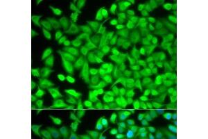 Immunofluorescence analysis of MCF-7 cells using FBP1 Polyclonal Antibody (FBP1 Antikörper)