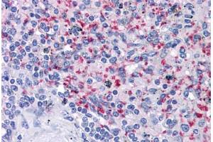 Human Spleen: Formalin-Fixed, Paraffin-Embedded (FFPE) (Integrin beta 3 Antikörper)