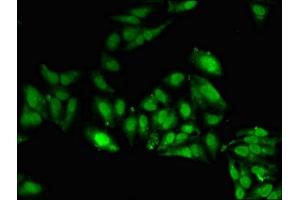 Immunofluorescent analysis of Hela cells using ABIN7169412 at dilution of 1:100 and Alexa Fluor 488-congugated AffiniPure Goat Anti-Rabbit IgG(H+L) (SETD5 Antikörper  (AA 519-700))