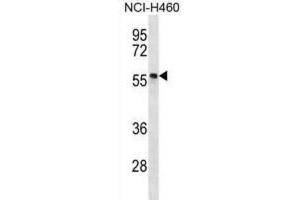 Western Blotting (WB) image for anti-phosphorylated Adaptor For RNA Export (PHAX) antibody (ABIN2996978) (PHAX Antikörper)