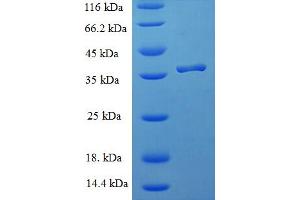 SDS-PAGE (SDS) image for Immature Colon Carcinoma Transcript 1 (ICT1) (AA 30-206) protein (His-SUMO Tag) (ABIN5711249) (ICT1 Protein (AA 30-206) (His-SUMO Tag))