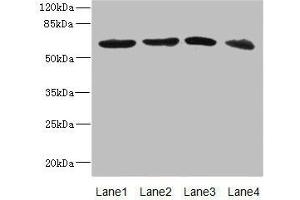 Western blot All lanes: RGS14 antibody at 3. (RGS14 Antikörper  (AA 230-510))