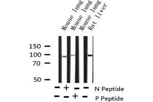Western blot analysis of Phospho-STAT5B (Ser731) expression in various lysates (STAT5B Antikörper  (pSer731))