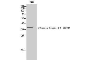 Western Blotting (WB) image for anti-Casein Kinase 1, alpha 1 (CSNK1A1) (pTyr294) antibody (ABIN3182662) (CSNK1A1 Antikörper  (pTyr294))