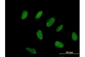 Immunofluorescence of purified MaxPab antibody to FLJ38288 on HeLa cell. (ZNF776 Antikörper  (AA 1-476))