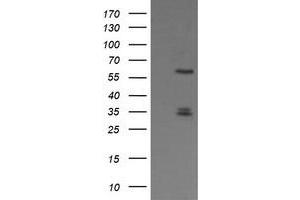 Image no. 1 for anti-Polo-Like Kinase 1 (PLK1) antibody (ABIN1500284) (PLK1 Antikörper)