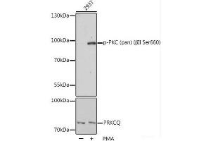 Western blot analysis of extracts of 293T cells using Phospho-PKC (pan) (βII Ser660) Polyclonal Antibody at dilution of 1:1000.