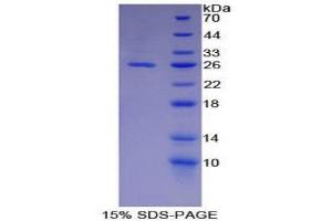 SDS-PAGE (SDS) image for Chordin (CHRD) (AA 422-635) protein (His tag) (ABIN2124330) (Chordin Protein (CHRD) (AA 422-635) (His tag))