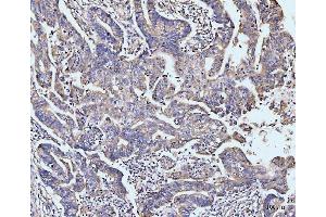 IHC analysis of MAP4K1/HPK1 using anti-MAP4K1/HPK1 antibody (ABIN7601232).