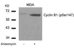 Image no. 3 for anti-Cyclin B1 (CCNB1) (pSer147) antibody (ABIN401595) (Cyclin B1 Antikörper  (pSer147))