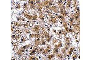 Immunohistochemistry of AFAP1L2 in human liver tissue with AFAP1L2 polyclonal antibody  at 2.