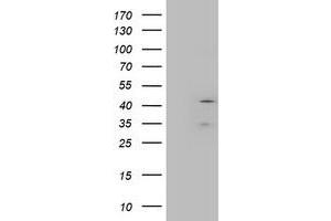 Western Blotting (WB) image for anti-Layilin (LAYN) antibody (ABIN1499101) (Layilin Antikörper)
